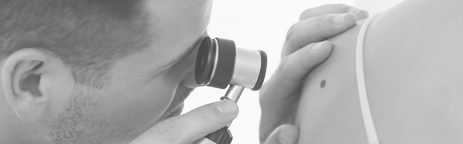 Dermoscopes and dermatology diagnostics