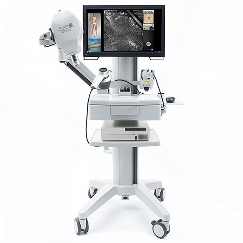 VivaScope confocal laser imaging system