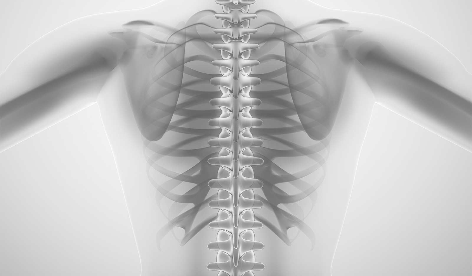 Spinal surgery products
