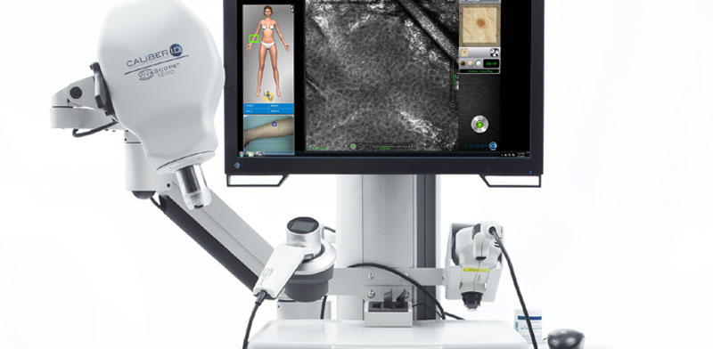 VivaScope 1500 and 3000 confocal laser imaging systems